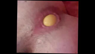 Video 1091296565: gaping prolapsed ass hole, fisting gape prolapse, solo ass gape, dildo ass fisting, gaping boy ass, gapes ass inserts, dildo balls, hungry gaping, gape self