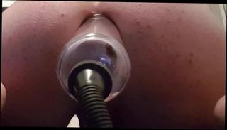 Video 219741004: pump prolapse, dildo prolapse, pump huge dildos, toys prolapse, anal prolapse, insertion prolapse, pumps guy, amateur gay fisting, toy gay man, anal destruction, german anal, fisting hd