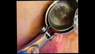 Video 1401740205: speculum gaping, speculum ass, gaped amateur, gaping gay, speculum stretching, speculum opens, ass cleaning