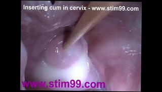 Video 59622355: creampie closeup pussy, closeup fuck creampie, bukkake creampie, closeup pussy cum, creampie pussy stretch, extreme cums bukkakes, creampie huge cum, pussy speculum, vagina closeup, inserts speculum, semen cum, pussy stretched wide