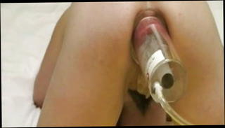 Video 134240601: anal prolapse pump, anal pump toy, pumping sex toy, prolapsed ass holes, tight ass hole pumped, prolapse suck, extreme anal prolapse, woman pumps, girl prolapse, prolapse masturbation, insertion prolapse, red prolapse, brunette pumped, women sex toys, anal sex straight, brutal sex toy, tight ass hole stuffed