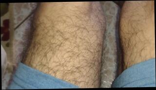 Watch the video about Hairy man knees hairy guy Feet Worship jun 4 I love my feet