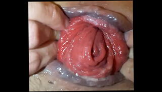 Video 784879135: fisting prolapse, prolapse gay, hole prolapse, huge prolapse, deep gay fisting